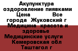 Акупунктура, оздоровление пиявками › Цена ­ 3 000 - Все города, Жуковский г. Медицина, красота и здоровье » Медицинские услуги   . Кемеровская обл.,Таштагол г.